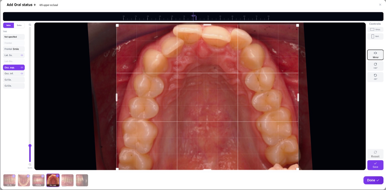 Editor foto intraorali DentalFlow